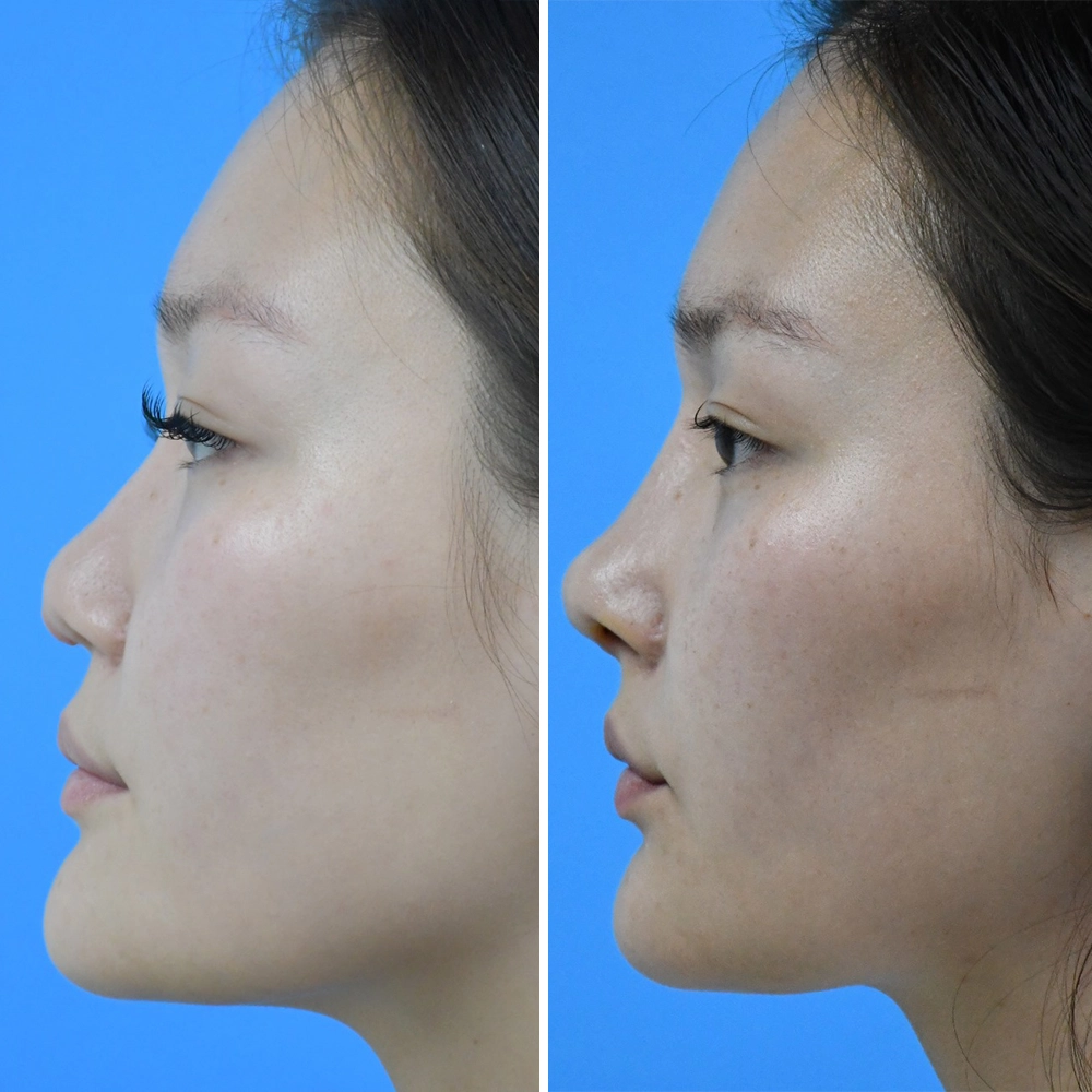 Ethnic Nose